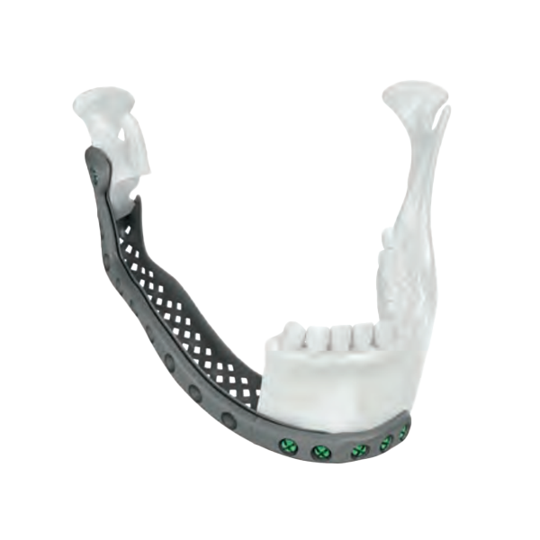 mandible-reconstruction-01