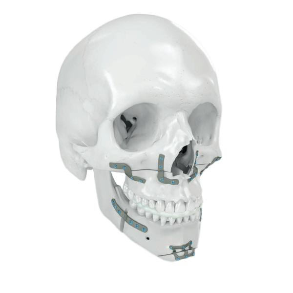 orthognathics-01