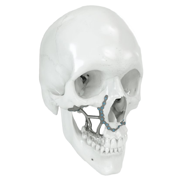 preprosthetic-001