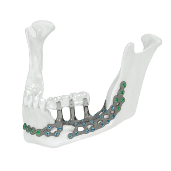 preprosthetic-002 (1)